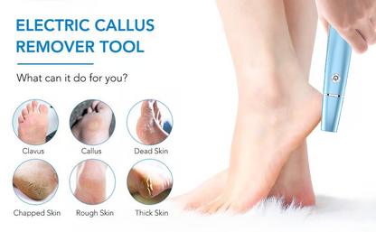 Electric Feet Callus Remover?